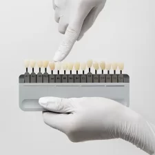 When to Schedule a Follow-Up After Veneer Placement in Plano